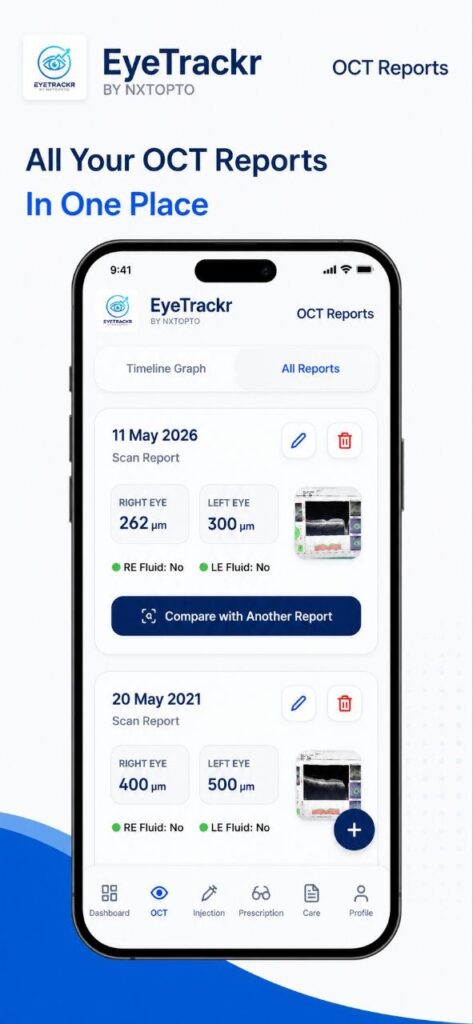 Eyetrackr photo 2026 07 10 22 09 31